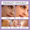 Whitening Freckle Cream Melasma Dark Spots Pigmentation Removal Product Fade Stain Melanin Fast Repair Brighten Korean Skin Care