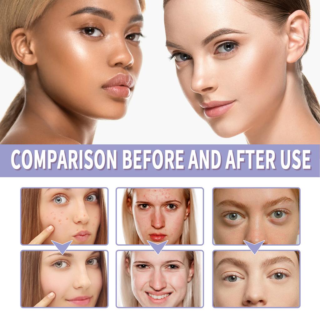 Kontrolní prášek s levandulovým olejem, spárovaný s nádechem, poskytuje hedvábnou a dlouhotrvající kontrolu mastnoty, vytváří hladkou pokožku