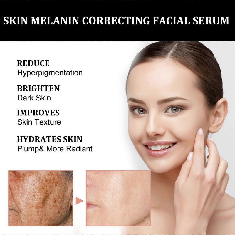 Melanin Correcting Facial Serum, Fade Dark Spots Anti Freckle Melasma Remover Lightening Pigment Blemish Vitamin C Face Essence