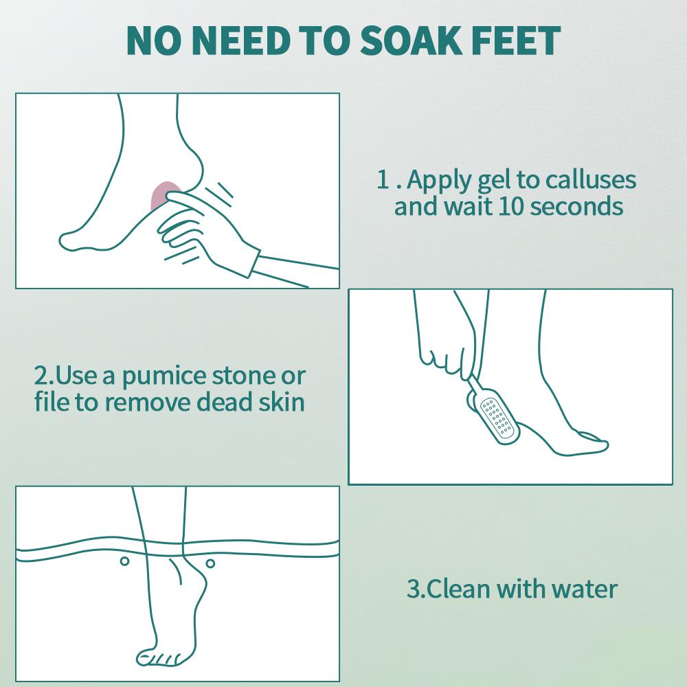 Nailpop Profesjonalny Usuwacz Modzeli do Stóp Ekstra Mocny Żel i Zestaw Pilnika do Stóp Usuwacz Martwego Naskórka Popękane Pięty Sucha Skóra
