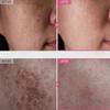 TOSOWOONG Arbutin 7% Tranexamic Acid 4% Cream 50ml Brightening K-Beauty 2025