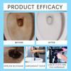 Jakehoe Toilet Cleaner | Removes Urine Scale & Stains | Eliminates Toilet Odor | Automatic Toilet Bowl Cleaner 120g