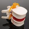 Human Anatomy Skeleton Spine Lumbar Disc Herniation Brain Skull Model Traumatic Pistol Medical Teaching Instrument for School