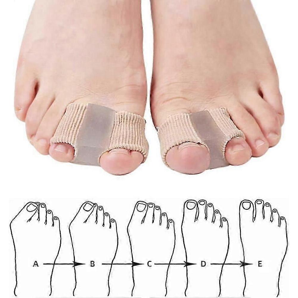 2 Stück Große Zehentrenner, Verstellbarer Silikon-Zehenkorrektor für überlappende Zehen, Hallux Valgus Ballenzehen-Linderung, Unisex Zehentrenner