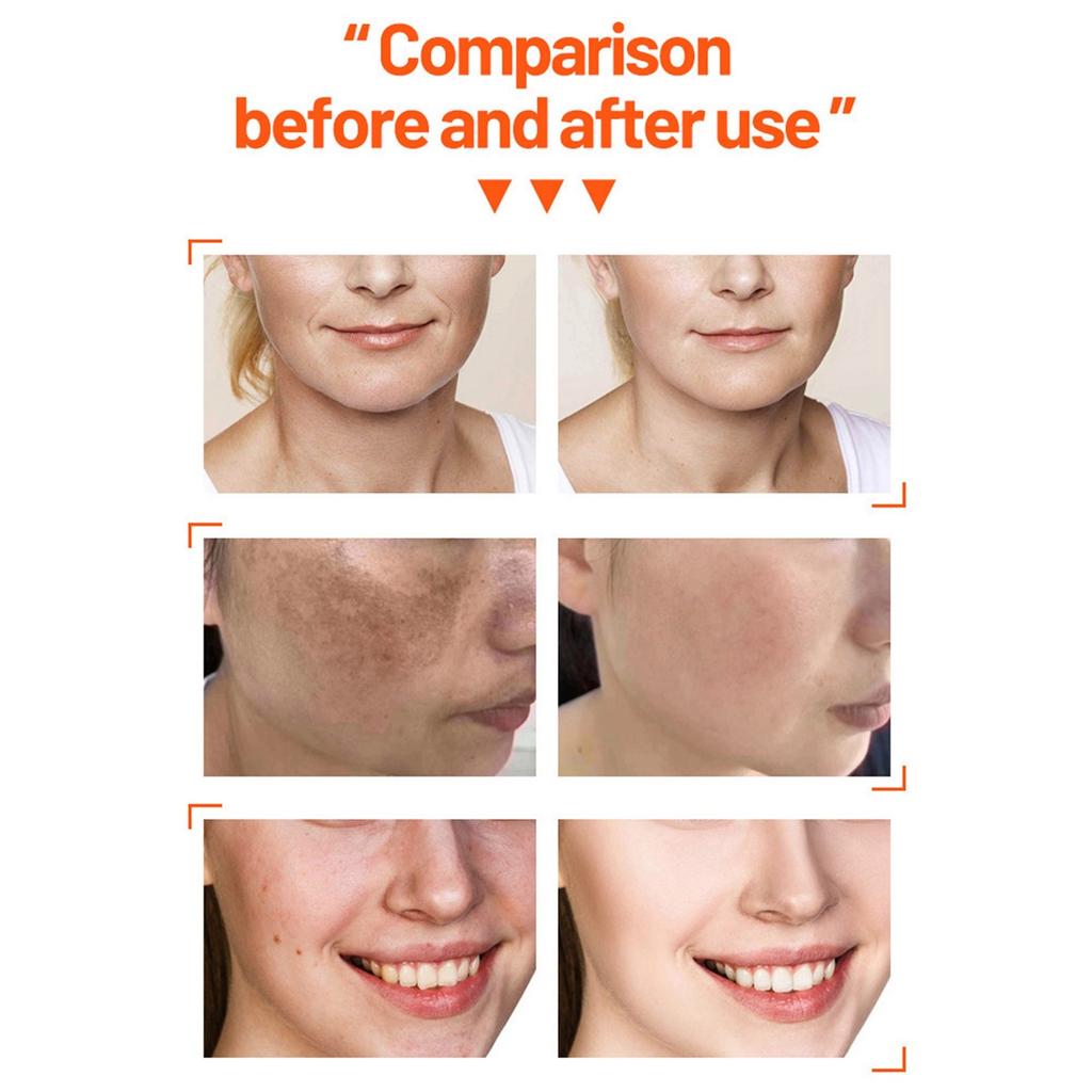 Travel Skin Care Set, Hyaluronic Set, Cleansing And Moisturizing Facial Care Set, Brightening Skin Tone 4pcs(30ml+30ml+10ml+15g)