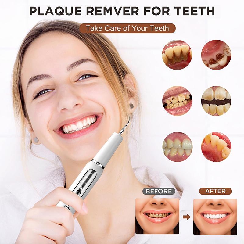 Ultrasonic Dental Scaler For Teeth Tartar Stain Tooth Calculus Remover Electric Sonic Teeth Plaque Cleaner Dental Stone Removal