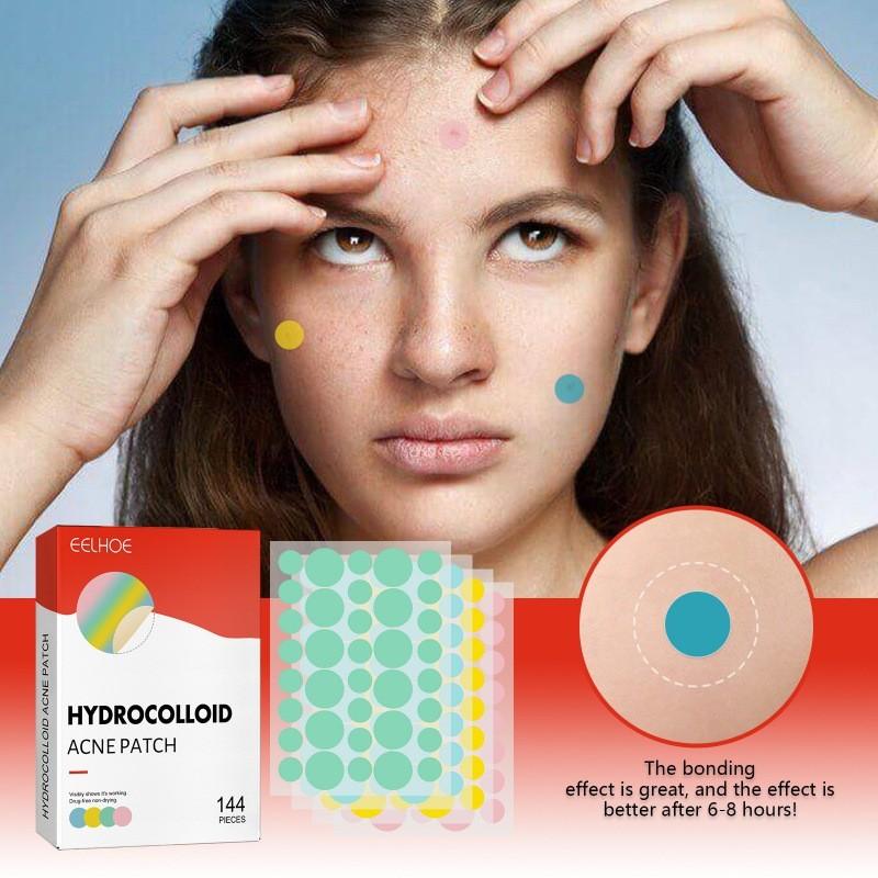 Eelhoe Colorful Acne Patches Gentle Non-irritating Hydrocolloid Treatment For Blemishes And Pimples 144pcs