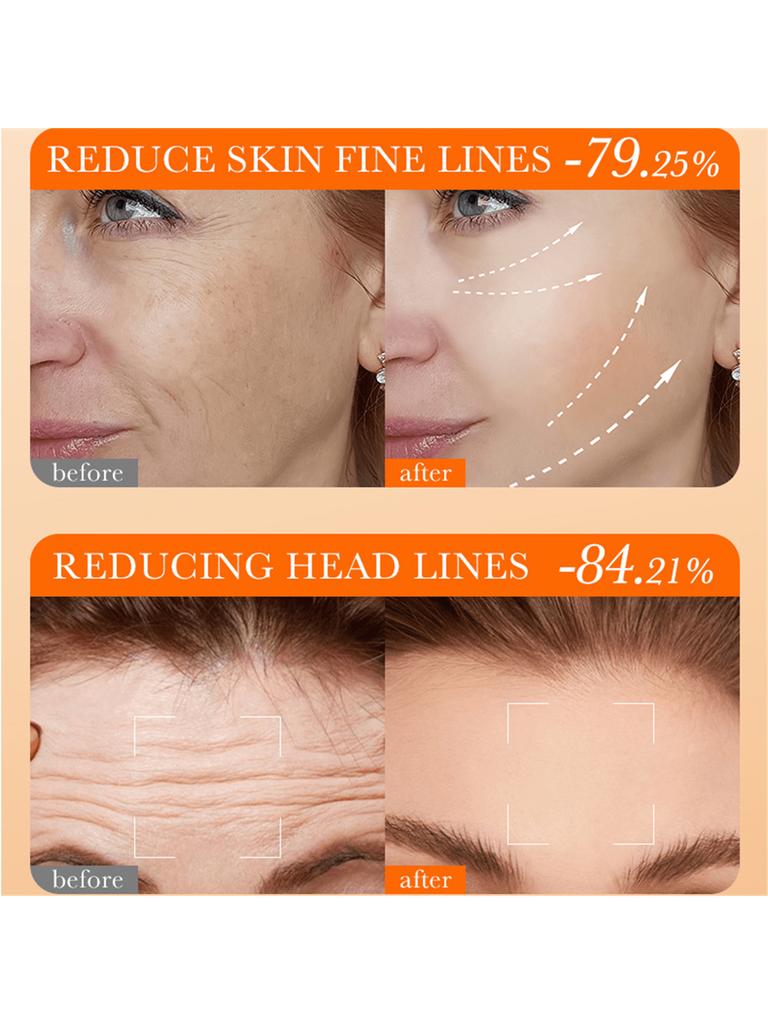 5Pcs Set Vitamin Cheek Forehead Filler Set Fill And Lighten Fine Lines In Skin Firms The Skin Improv