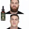 Óleo de crescimento rápido da barba, óleo para homens, cafeína, soro natural de crescimento da barba, promove o crescimento do cabelo, queratina profissional