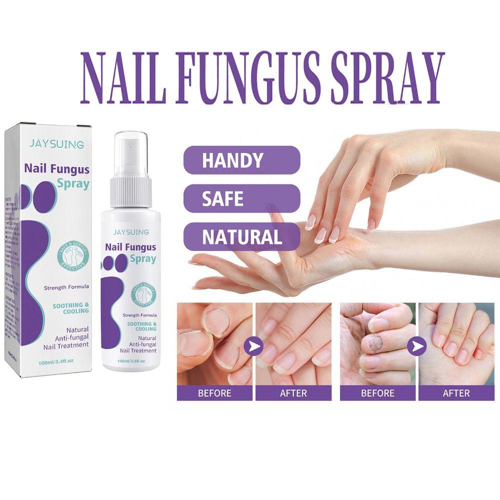 Nail Care Spray 100ml Nail Fungus Spray Nail Infection Treatment