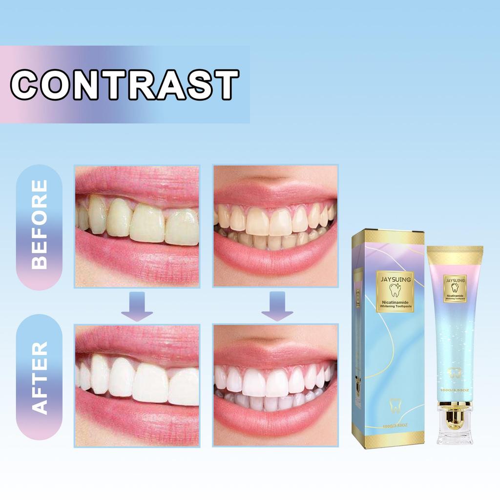 Whitening Toothpaste Gentle Cleaning Stained Teeth Yellow Tartar Care Gums Fresh Breath Whitening Toothpaste