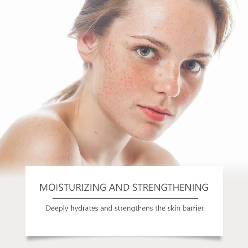 Retinol Whitening Freckle Cream Melasma Dark Spots Pigmentation Removal Fade Stain Melanin Fast Repair Brighten Korean Skin Care