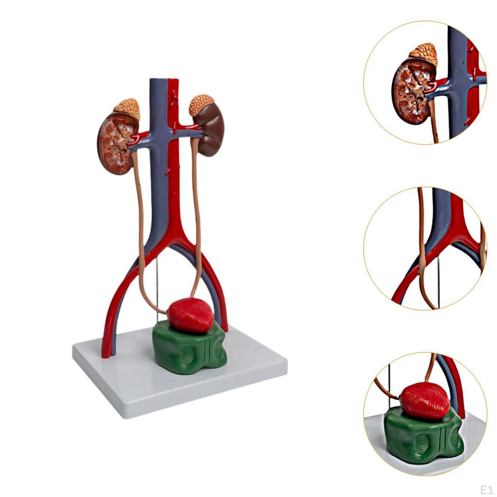 Urogenital System Model Demonstration Renal Structural Experiment Educational Tool