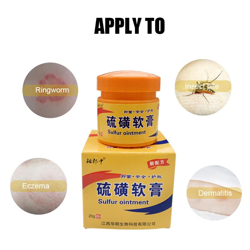 Sulfuric Moss Care Relieves Skin Itching, Redness, And Swelling. Cowhide Moss Moisturizing Skin Care