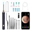 Wireless Ear Cleaning Camera with 5MP High Resolution Youmay Ear Cleaning Inversion Video Photo WIFI IP67 Ear Cleaning Ear Cleaning Earwax Cleaning