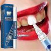 Teeth Tooth Whitening Gel Pen White Bleaching Dental Whitener White Teeth - CHUNC