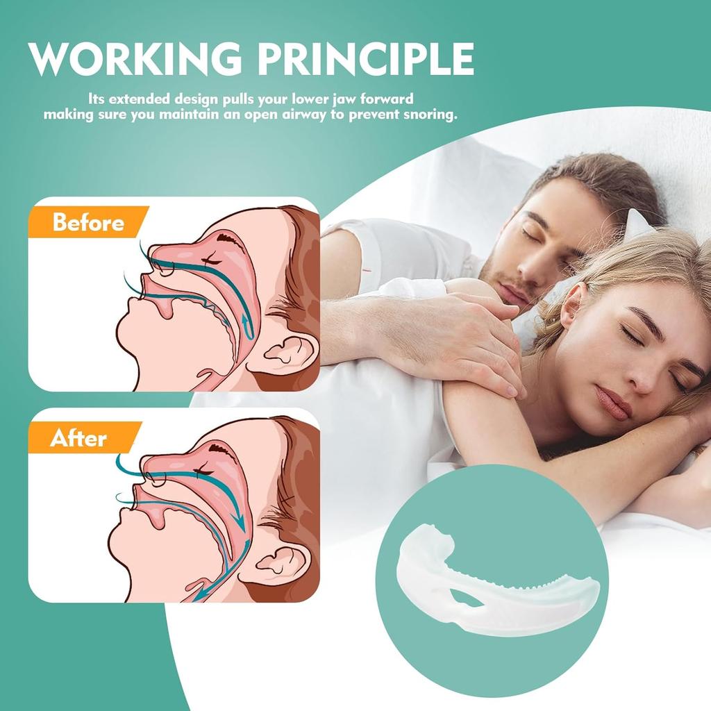 Anti-Snoring Mouth Guard-Anti-Snoring Device,Effective Snore Solution,Prevent Snoring Improve Sleep,Adjustable Design,Promote A Peaceful Sleep