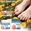 Onychomycosis Care Ointment, Nail Strengthening Cream, Nail Ointment To Strengthen Nails And Reduce Cracking