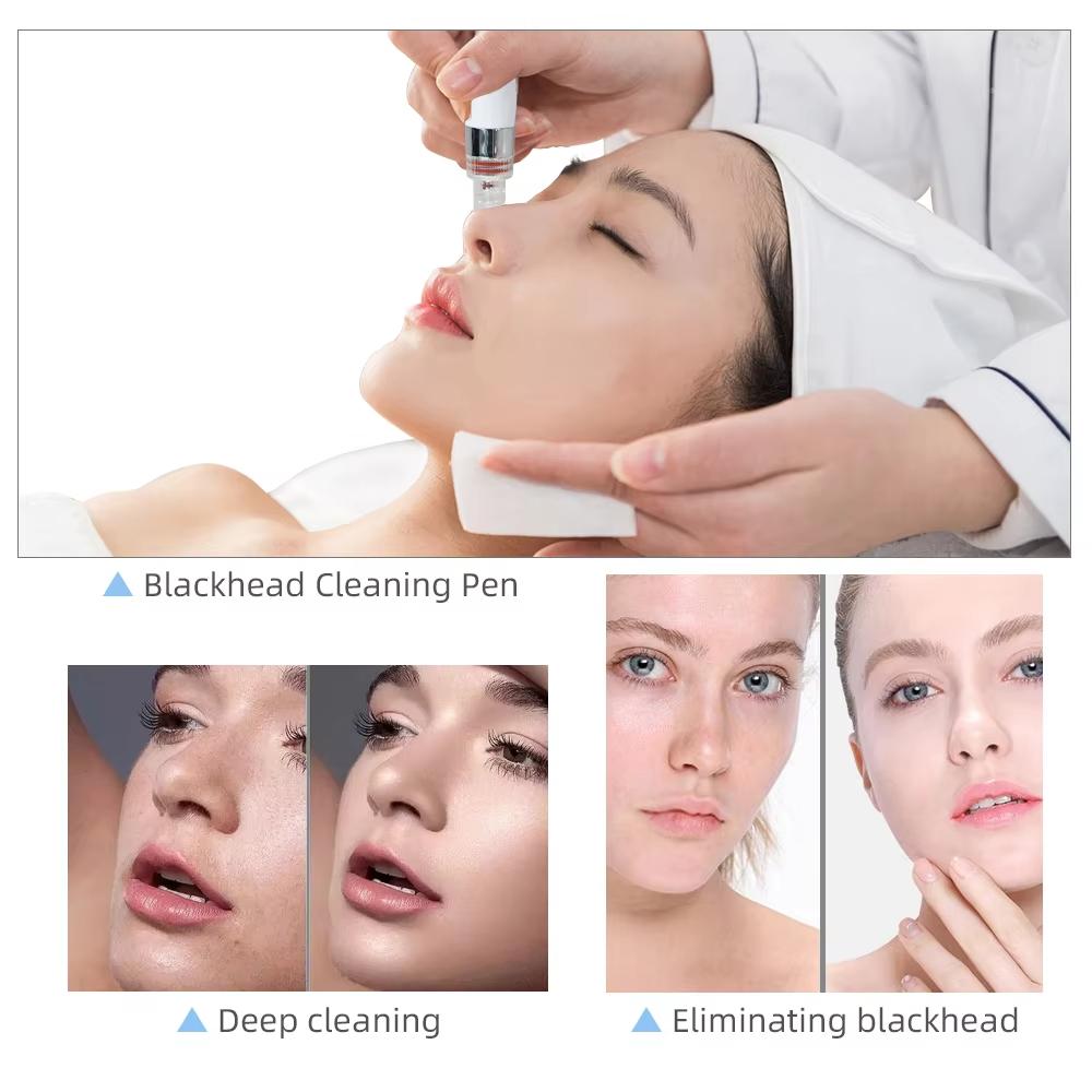 Hydro Wasser Sauerstoff Jet Peel Maschine Oxy Spray Gesichtsmaschine Gesichtsreinigung RF Lifting Dermabrasion Hautpflege Schönheitsgerät Spa