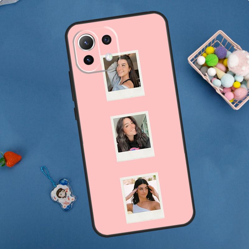 Charli D'Amelio Case For Xiaomi 14 13 15 Ultra 11T 12T 13T 14T Pro POCO X7 Pro X3 X5 F5 F6 M6 X6 Pro Cover