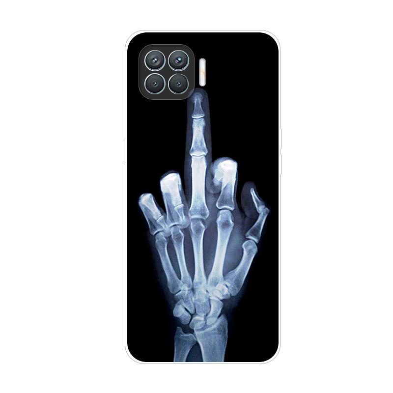 For OPPO Reno4 Lite Case Reno5 Lite Shockproof Soft silicone TPU Back Cover For OPPO Reno 5 4 Lite Phone Cases Case Cute Cartoon