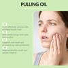 Pulling OilDental Care Mouthwash OilMouthwash Oil Helps Remove Bad Breath And Tartar Making Your Breath Fresher120ml