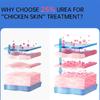 Body Whitening Cream Keratosis Pilaris Treatment Bumpy Rough Chicken Follicle Skin Repair Strawberry Legs Removal Dry Skin Care