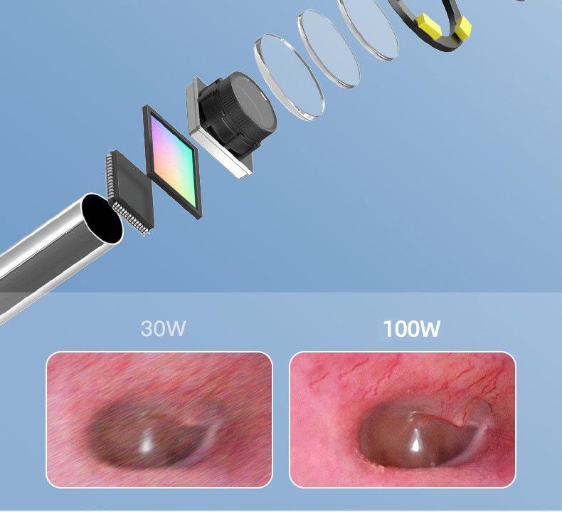Home Edition Smart Ohrreinigungs-Endoskop mit WiFi Inspektionsspiegel