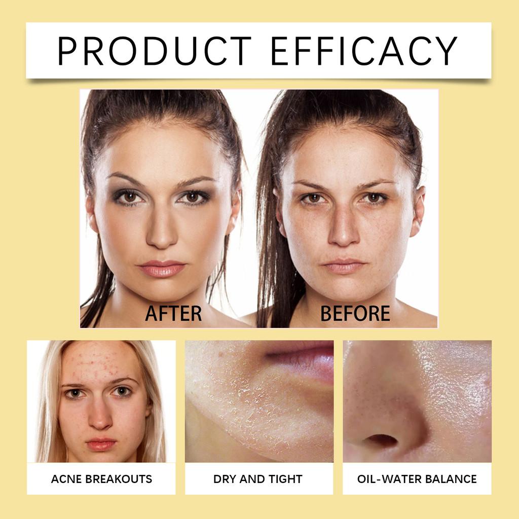 Nourishing Ginger Lemon Facial Cleansing Water Moisturizing Makeup Remover