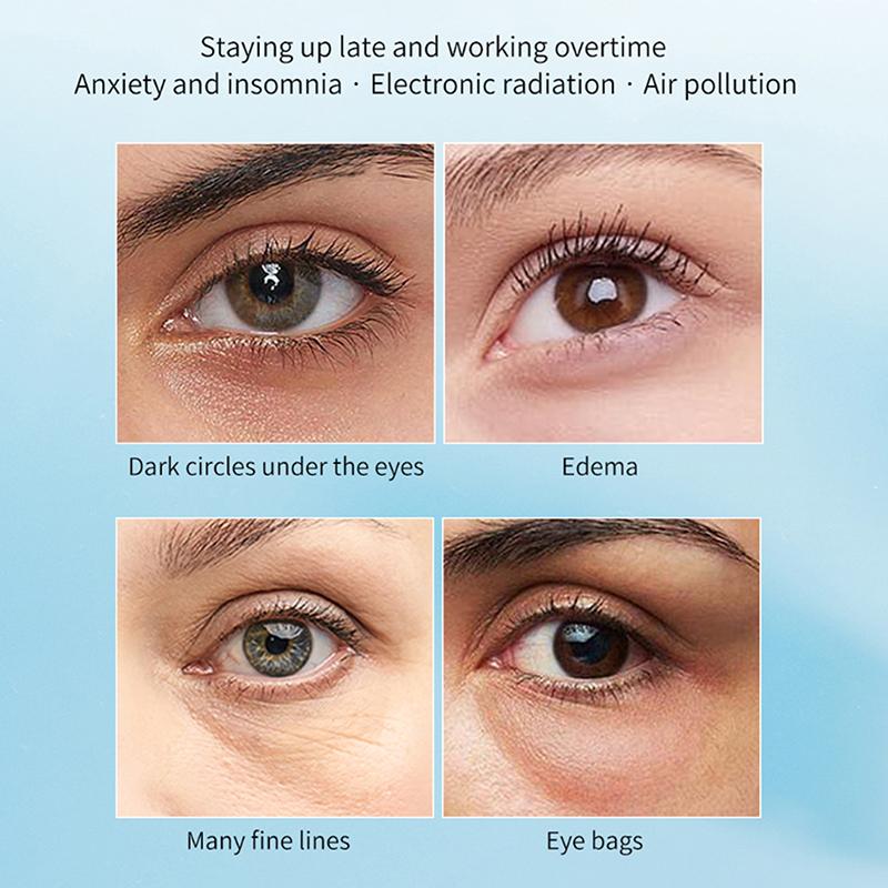 1/3Pairs Microneedle Eye Patches Mask Soluble Hyaluronic Acid Blemish Treatment Sticker 0.25mm Needle Length 2000 Microneedle