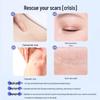 Kefu Yanbenshu Silicone Scar Removal Gel
