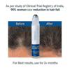 Be Bodywise Haarwachstums-Serum Roll-On - 3% Rosmarin, 3% Redensyl & 2% Biotin - Stimuliert Follikel Reduziert Haarausfall - 25ml