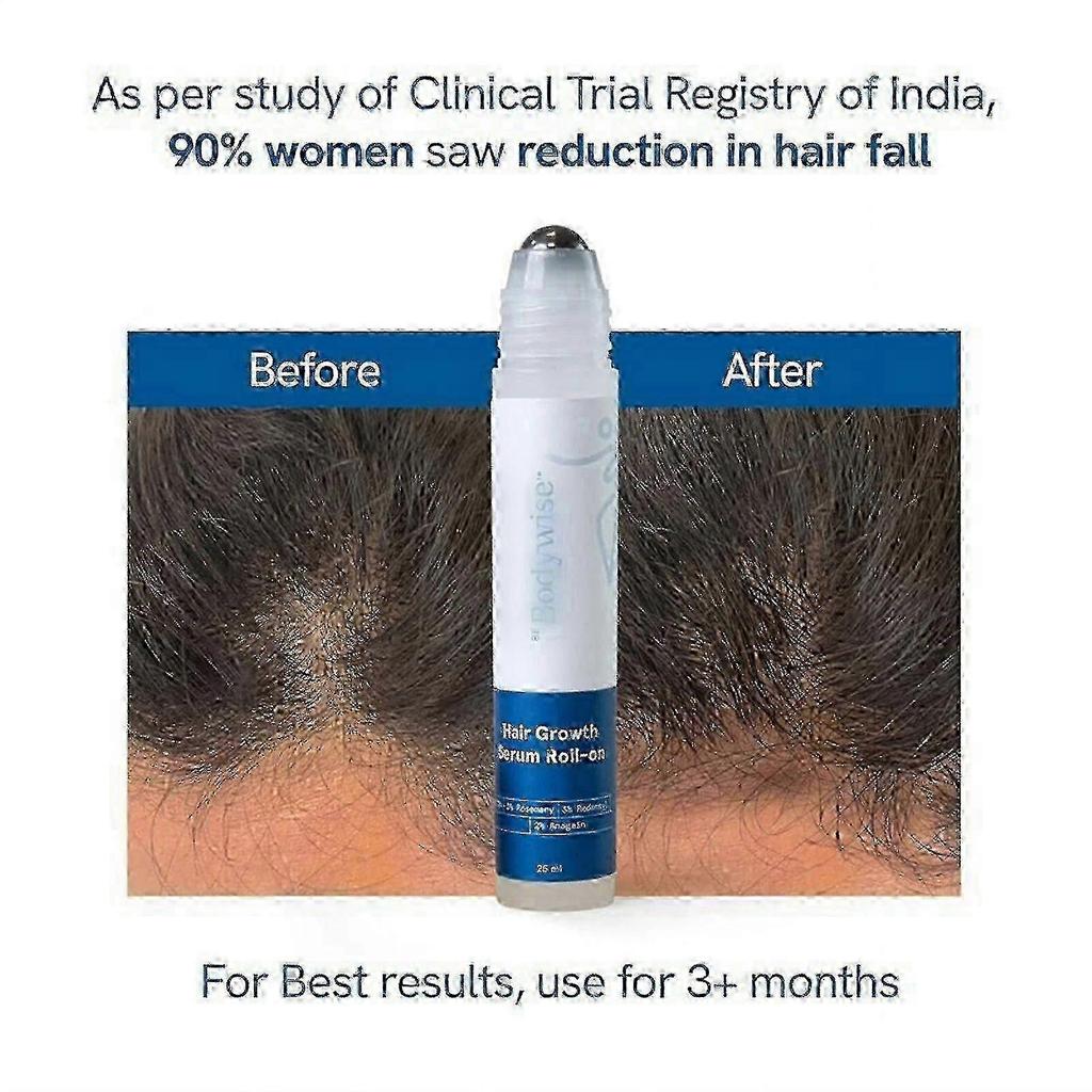 Be Bodywise Haarwachstums-Serum Roll-On - 3% Rosmarin, 3% Redensyl & 2% Biotin - Stimuliert Follikel Reduziert Haarausfall - 25ml