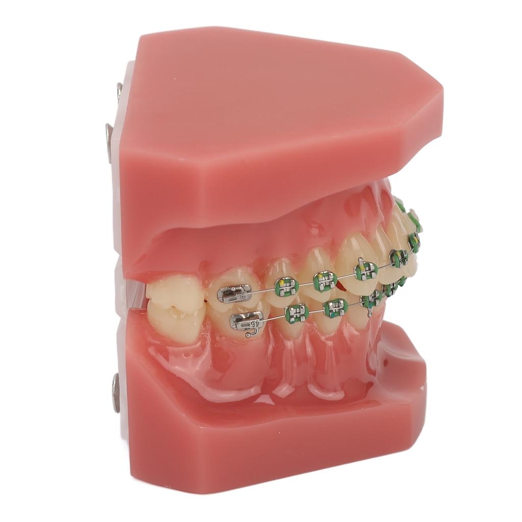 Dental Orthodontic Demonstration Model Teeth Model with Metal Wires and Bracket for Teaching Learning