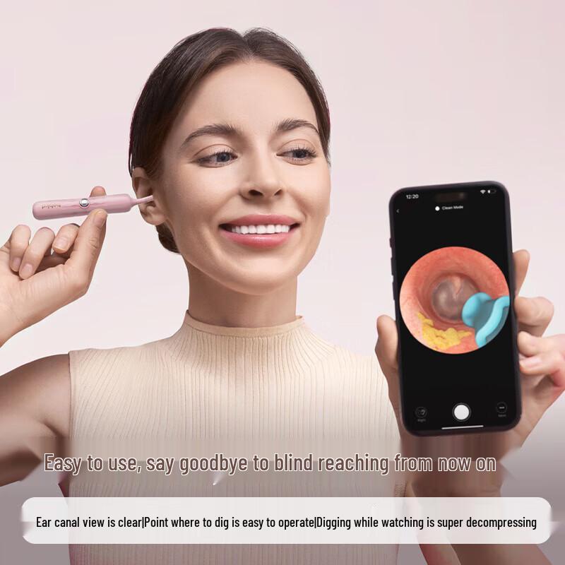 Bebird HD Visual Earwax Remover with Tweezers