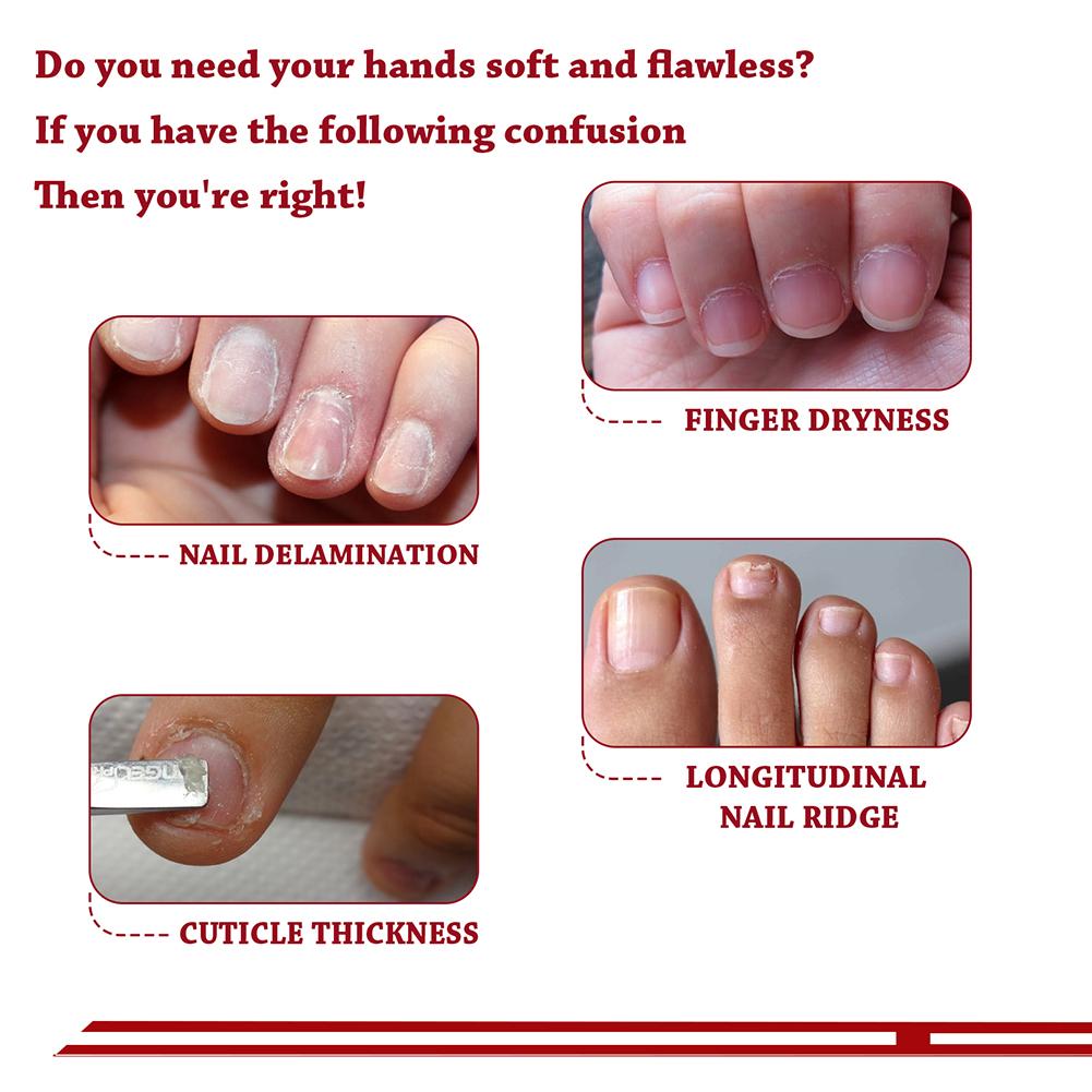 Buy Jojoba Nail Cuticle Oil Contain Vitamin B E Moisturizing Nourishing Essence at affordable