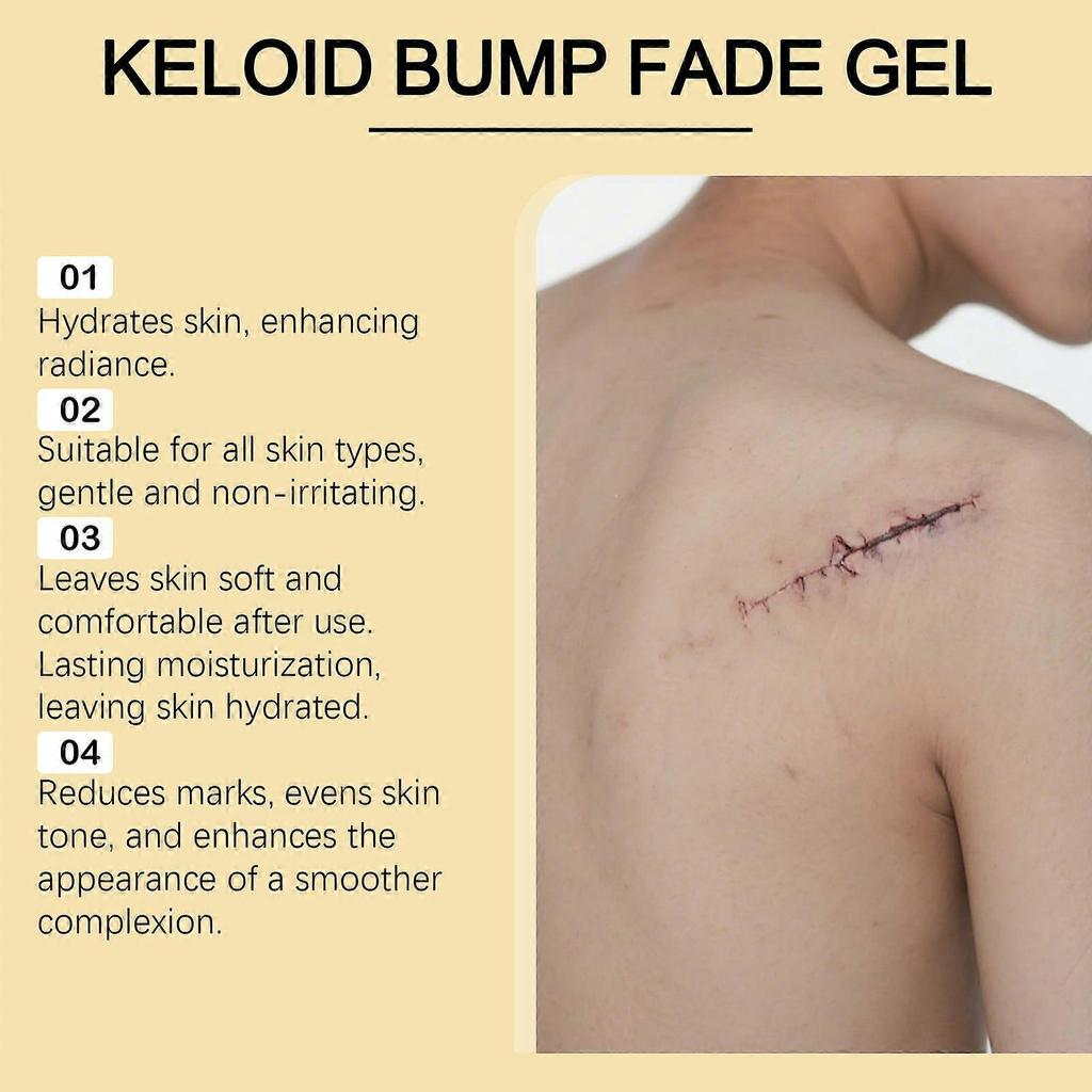Krém na jizvy 15 g s kyselinou hyaluronovou, Rychlé hojení a odstranění jizev, Účinná léčba, V krabičce