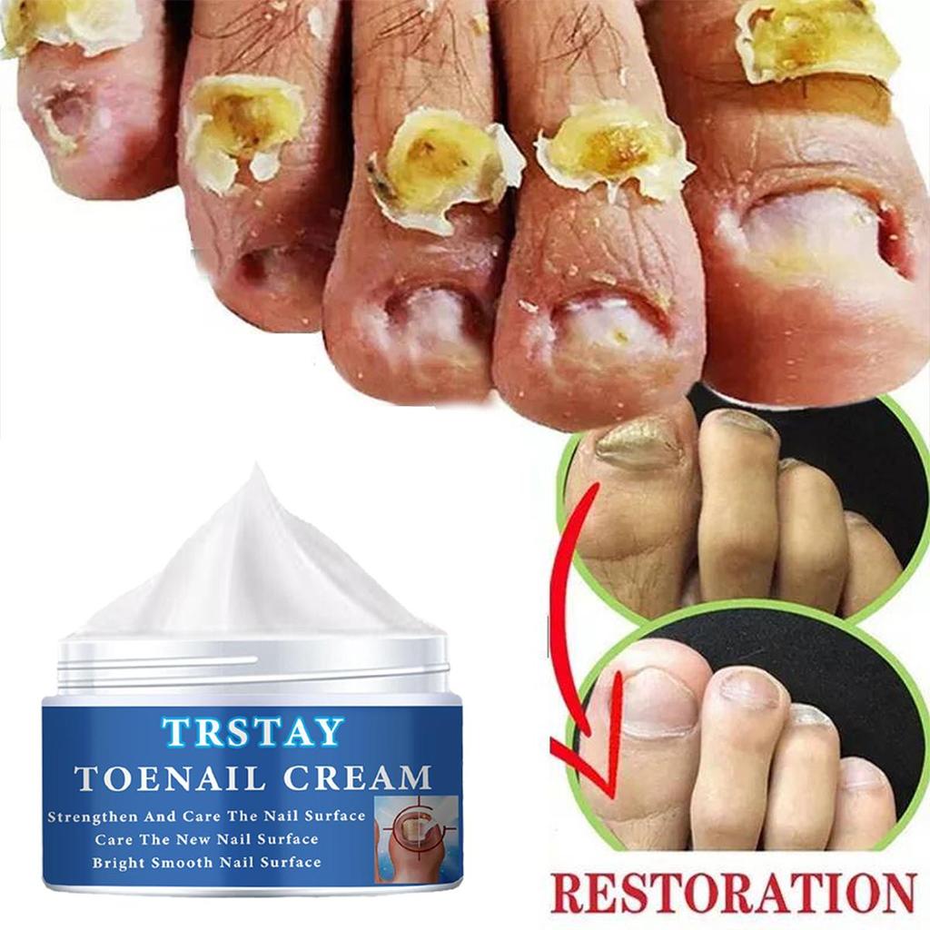 Výživa nehtů, čištění a hydratace, zklidňující hydratace, výživa nehtů, nehty tvrdé a lesklé