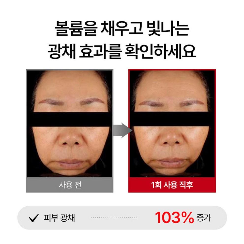 Meditherapy Shumage Shot Guldtrådlyftande Ampull