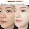 Qin Derdom Cushion Moisturizing suitable for dry skin Sweat and oil mousse pore coverage coverage Creates a look Glowing finish Refill included