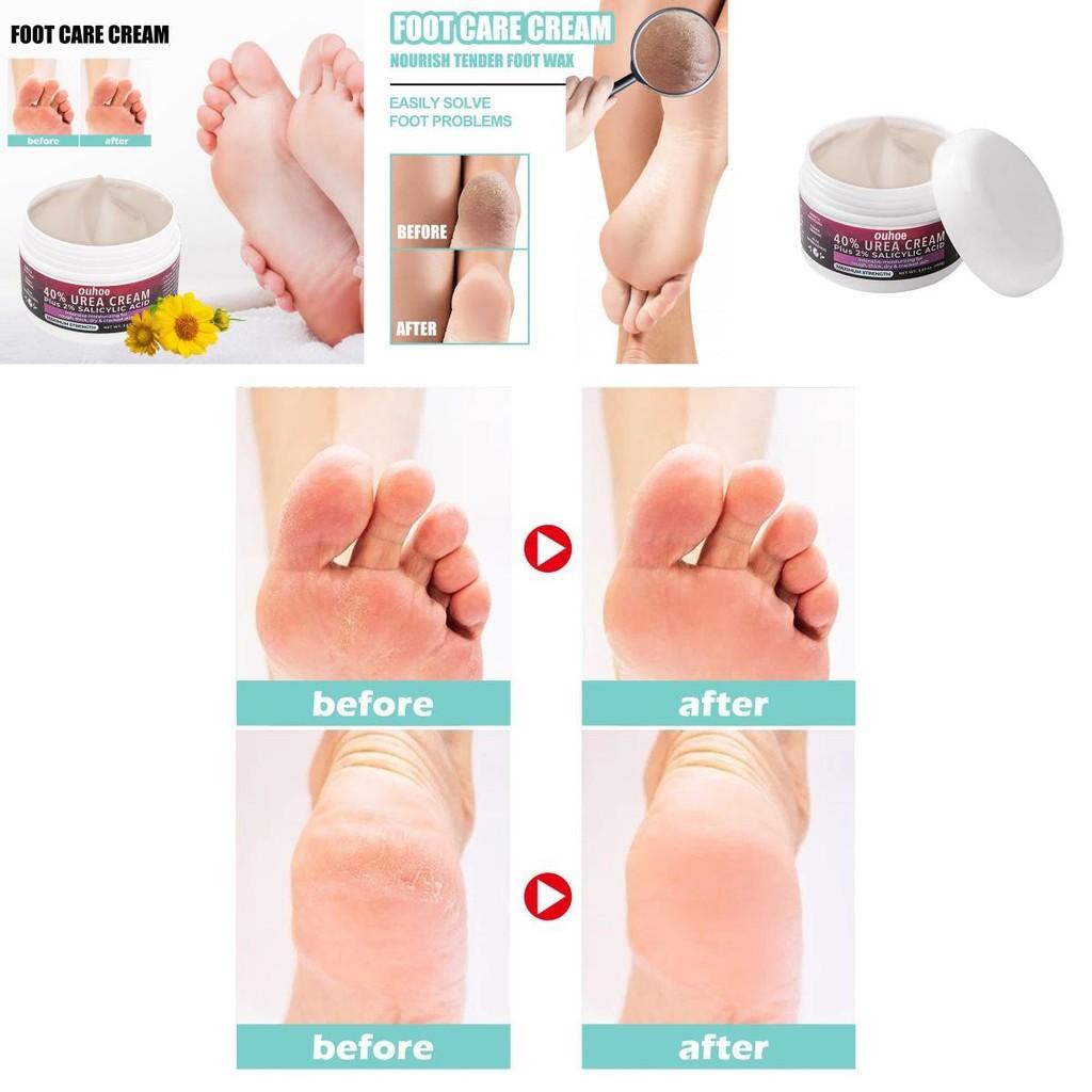 Ouhoe Moisturizing Foot Cream For Dry Cracked Heels And Rough Skin Repair 100g