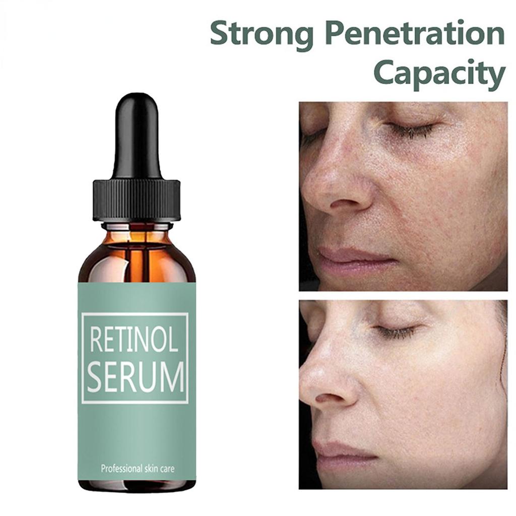 Anti Aging Face Cream, Rich In Collagen, Prevents Dry Lines, Moisturizes And Moisturizes