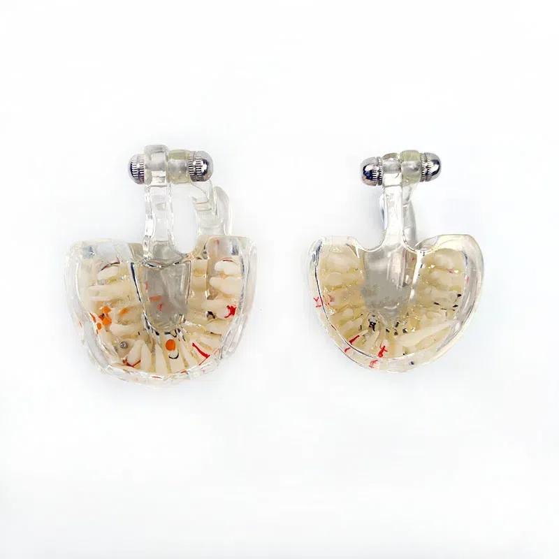 Dental Teaching Model Pathology Model With Half/Full Implant C1/C4 Dentist Laboratory Material Tools