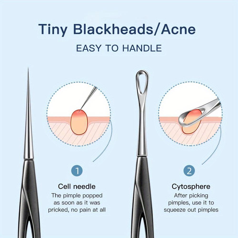 1/2Pcs Acne Needle Blackhead Clip Remover Extraction Popper Pore Black Head Cleaner Face Skin Care Deep Cleansing Needle Tool