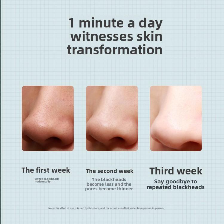 Blackhead Suction Beauty Instrument, Visual Blackhead Instrument Artifact, Electric Blackhead Suction Instrument