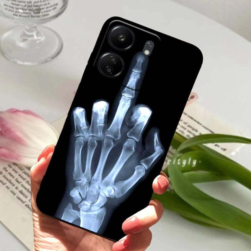 Cute Cartoon Soft Case For Redmi 13C 13 4G 5G Silicone TPU Phone Cover For Xiaomi Redmi 13R Phone Protective Fundas Capa Cases