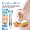 20g Lipoma Soothing Gel Instant Ointment Relieving Discomfort Agglomerat