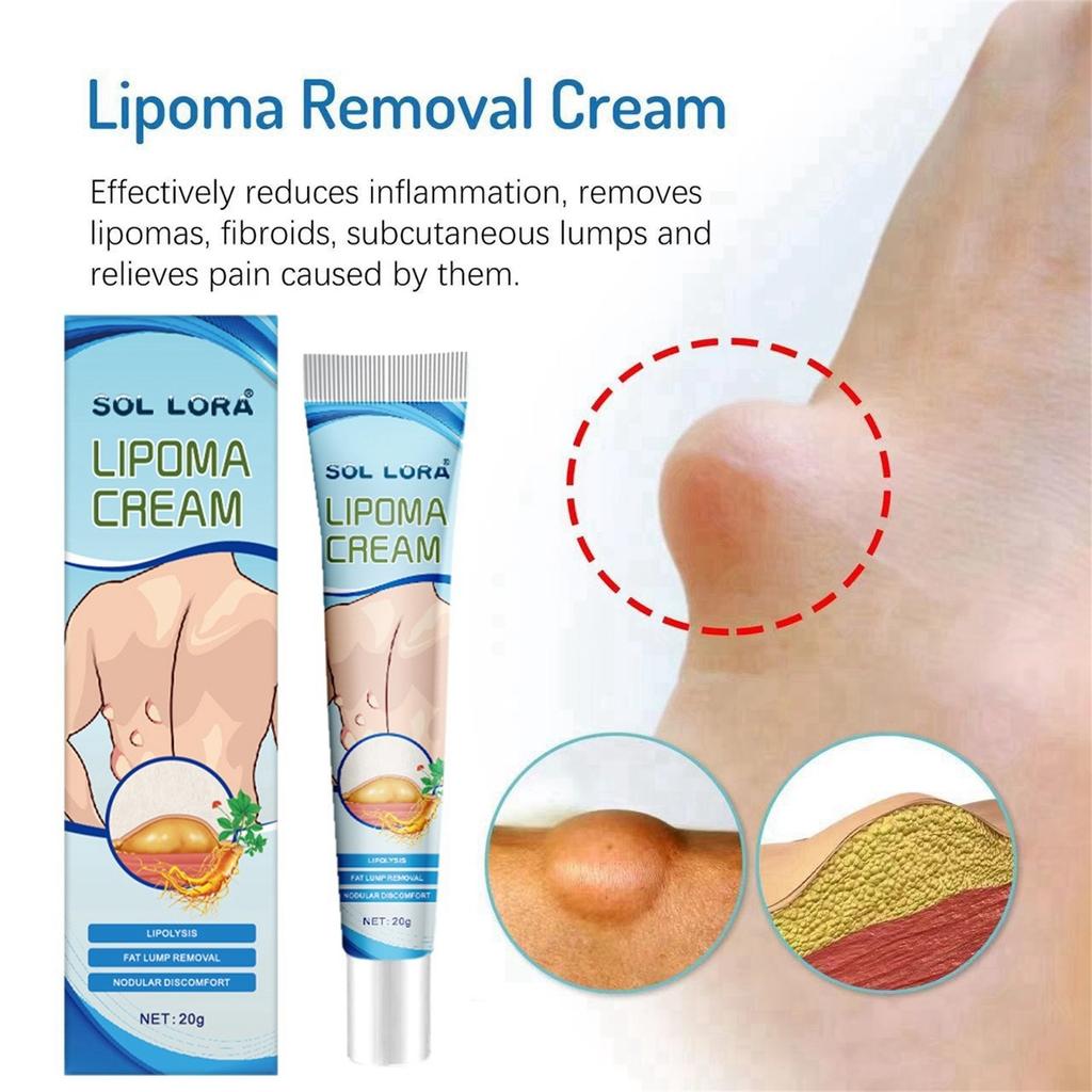 20g Lipoma Soothing Gel Instant Ointment Relieving Discomfort Agglomerat