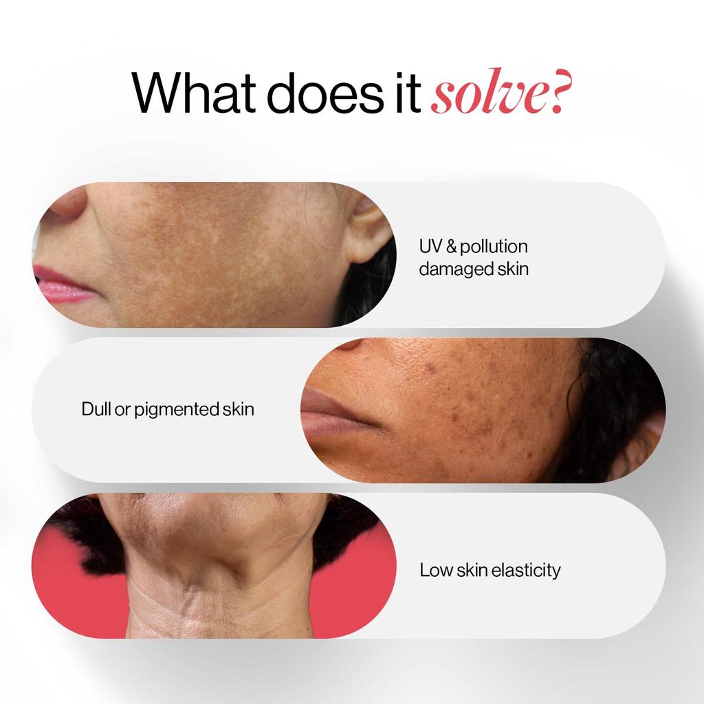 Be Bodywise Glutathion-Gummibärchen für reine, strahlende Haut | Reduziert Pigmentierung, verbessert die Ausstrahlung, schützt vor Umweltverschmutzung & UV-Schäden | L-Glutathion