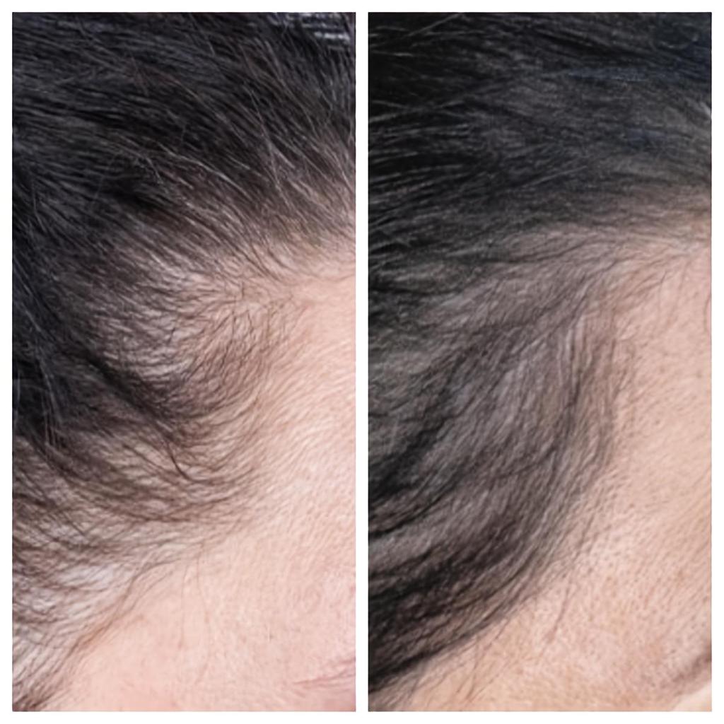 Rice Fermented Hair Growth Oil Essence Hair Oils Growth Serum Rich Nourishing Ingredients Promotes Thicker Stronger